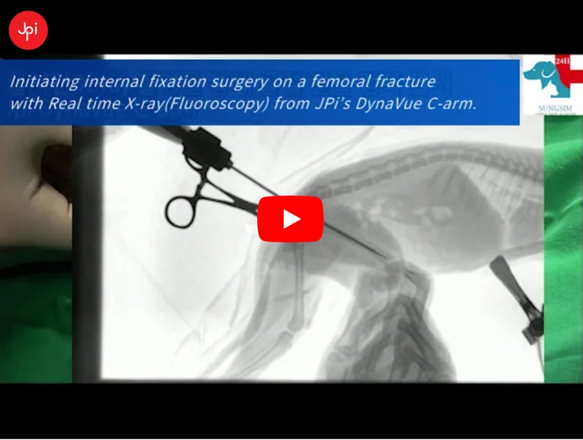DynaVue: Non Incision Pinning to Repair Femoral Fracture